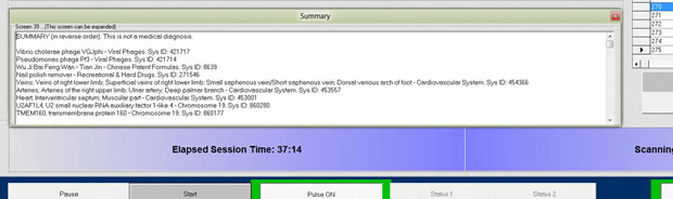 Summary window